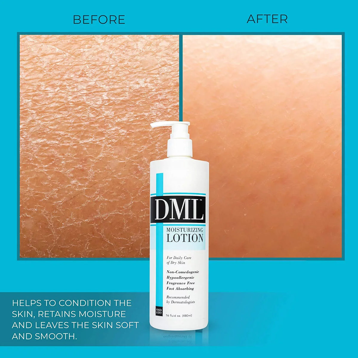 DML, 16 Unscented Moisturizer Oz. Pump Bottle Lotion