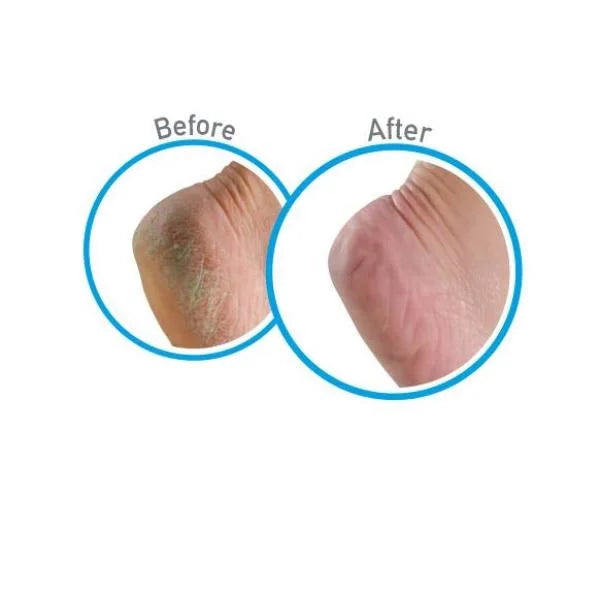 Foot Cream Healthy Feet 3oz. (5-Pack)