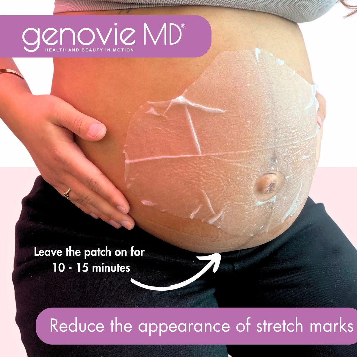 Miracle Patch GENOVIE Stretch Mark Maternal MD